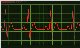 Moving to the rhythm of the SMS beat...